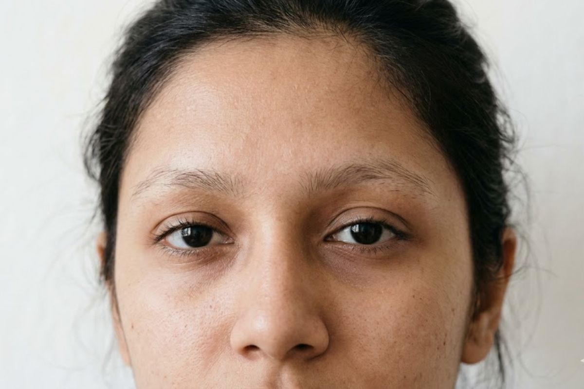 Before treatment